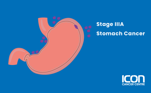 Stage IIIA